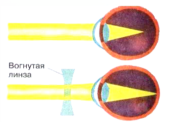 Что называется линзой в физике